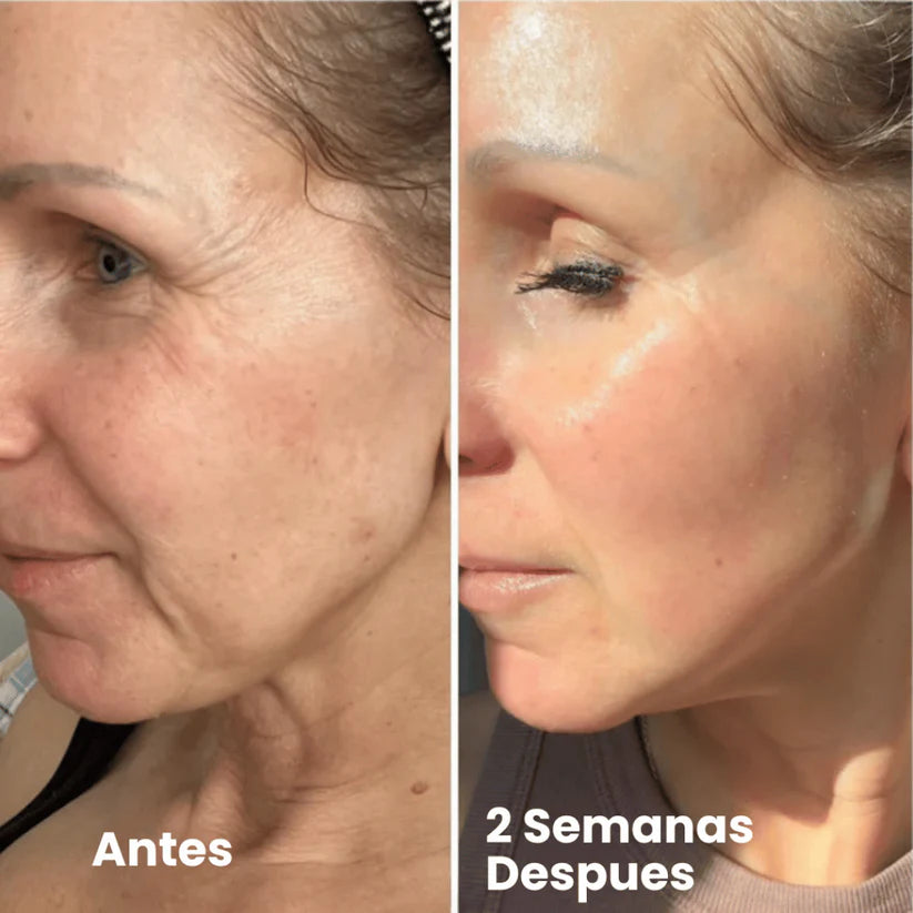 Retinal Shot: Rejuvenece tu rostro, despídete de arrugas