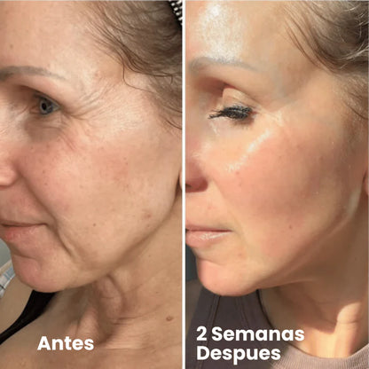 Retinal Shot: Rejuvenece tu rostro, despídete de arrugas