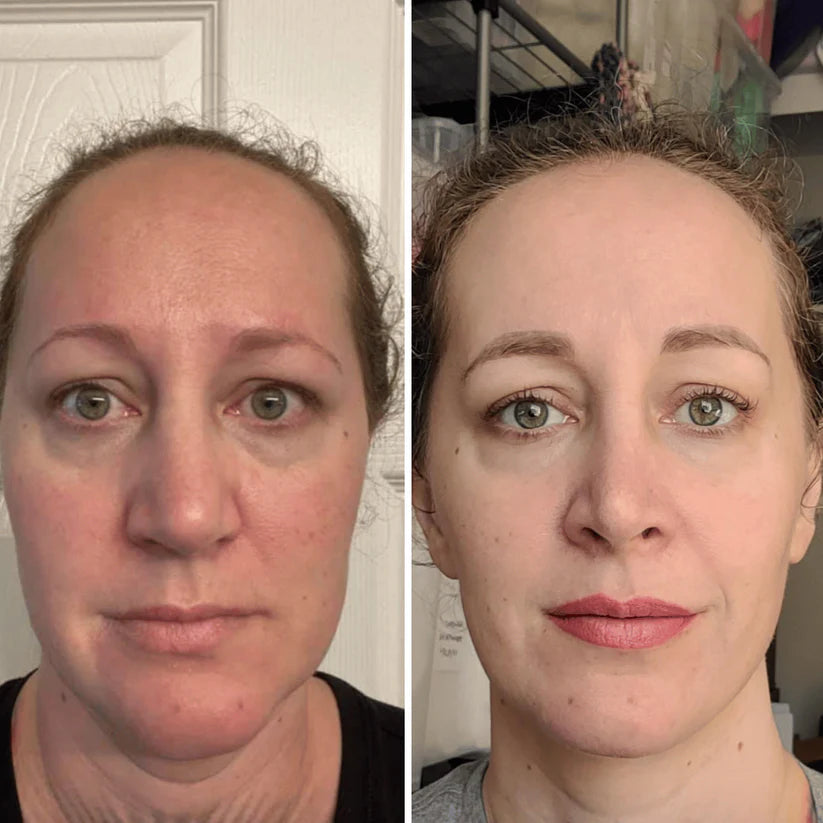 Retinal Shot: Rejuvenece tu rostro, despídete de arrugas