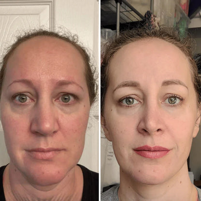 Retinal Shot: Rejuvenece tu rostro, despídete de arrugas