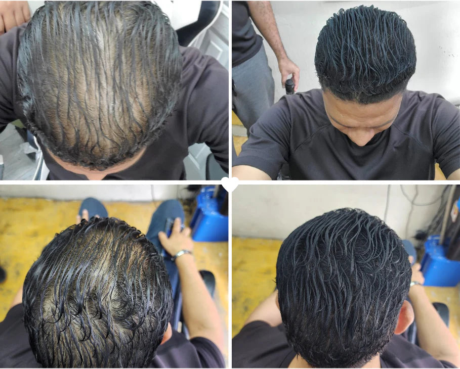 Toppik Fibra Capilar Instantánea – Cubre al Instante las Zonas con Baja Densidad