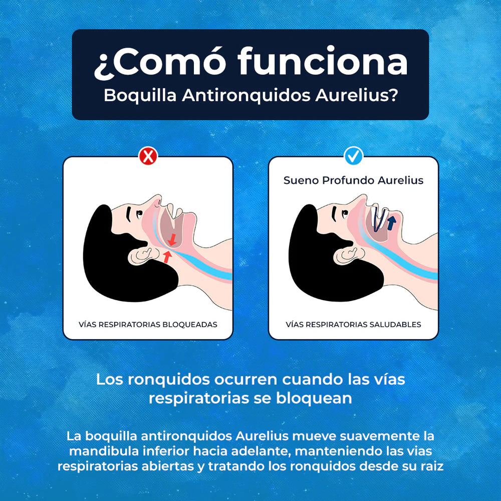 Protector Antirronquidos: Descansa Mejor y Duerme Más Tranquilo