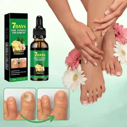 Fungiclear 7™ - Tratamiento anti hongos 100% Natural🍃